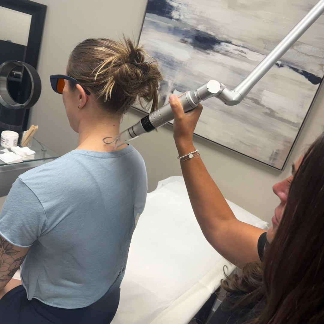 Technician performing laser tattoo removal with PiQo4 system at Eraditatt