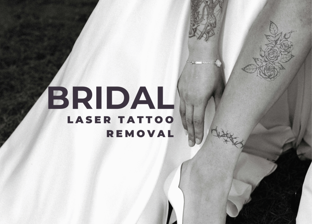 Bride preparing for her wedding dress while undergoing PiQo4 laser tattoo removal at Eraditatt.