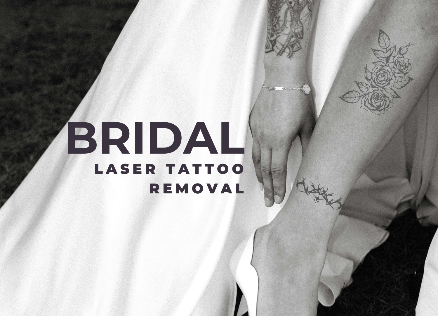 Bride preparing for her wedding dress while undergoing PiQo4 laser tattoo removal at Eraditatt.