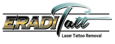 Laser Tattoo Removal Pricing Guide | Cost Breakdown + Size Chart | EradiTatt Florida