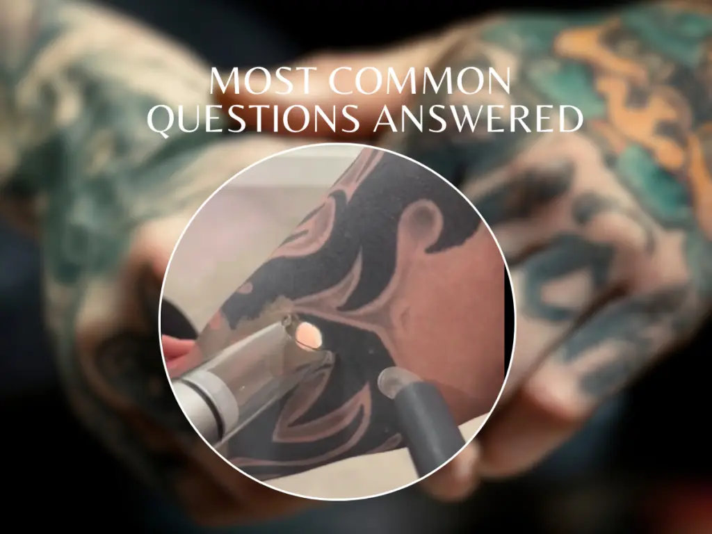 laser tattoo removal treatment using the PiQo4 laser