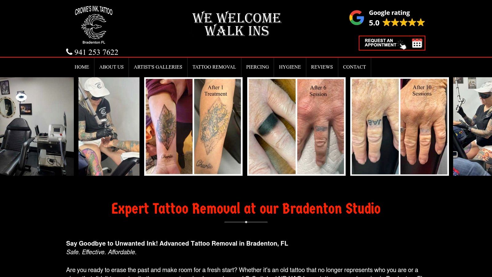Crowe's Ink Tattoos – Laser Tattoo Removal