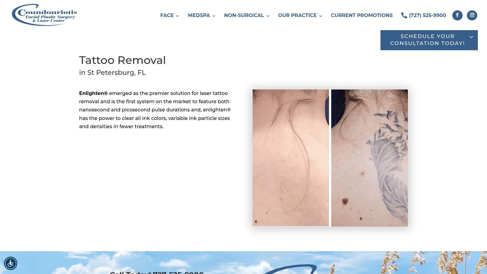 Removery – Tampa (Westshore)