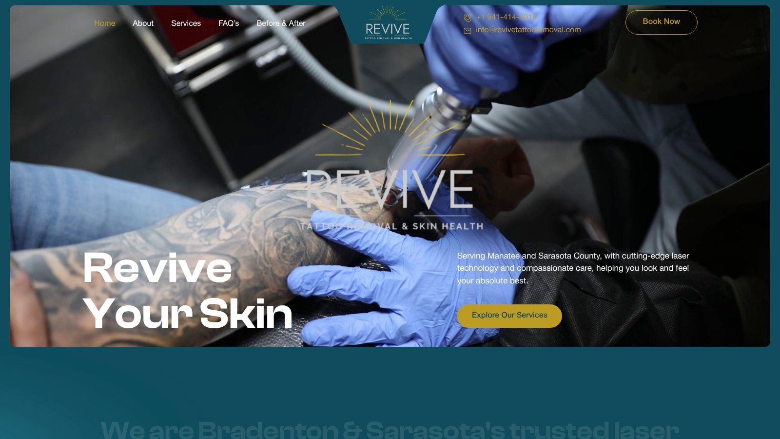 Case Study #4: Safe Removal on a Darker Skin Tone (Fitzpatrick V)