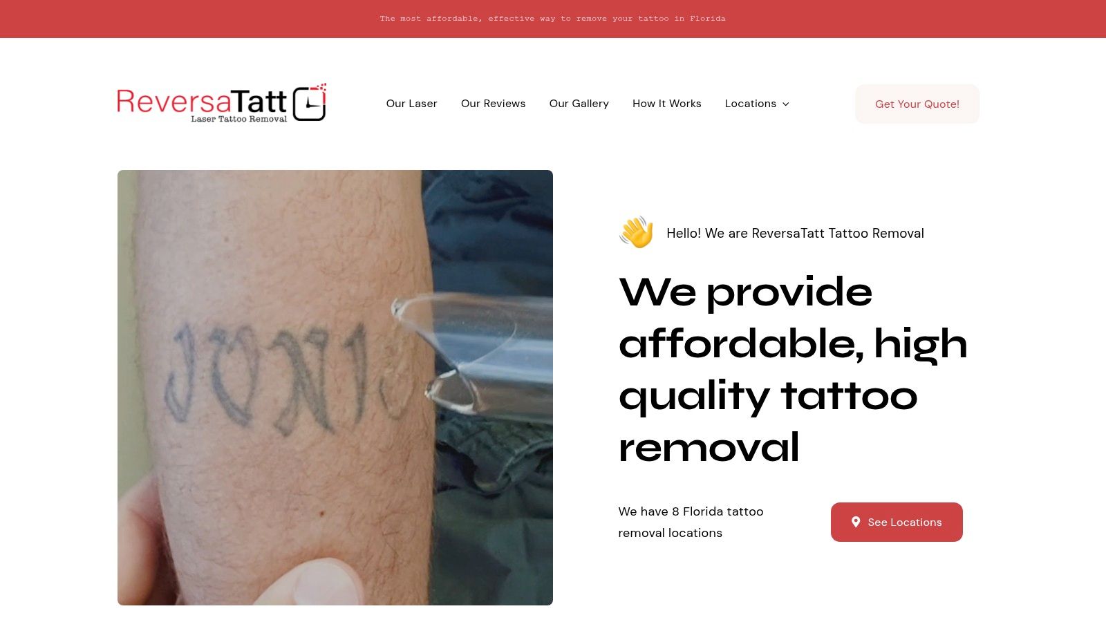 Case Study #3: Tackling Stubborn Blue & Green Ink on an Ankle