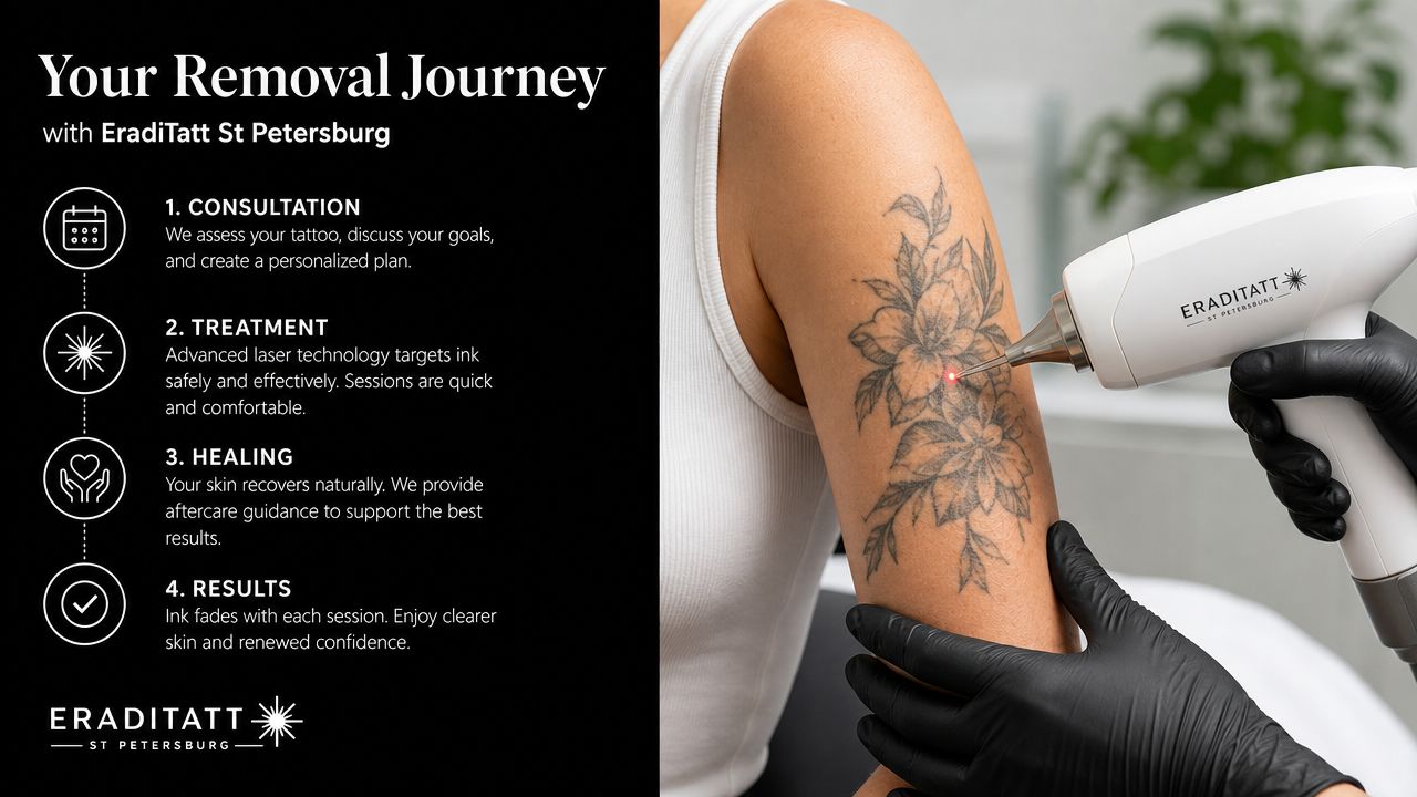 A professional laser tattoo removal treatment session at EradiTatt St Petersburg showing a laser on a client's arm.