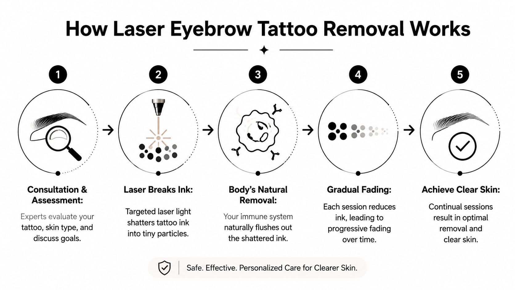 A five-step infographic showing how professional laser technology works to safely remove eyebrow tattoo ink.