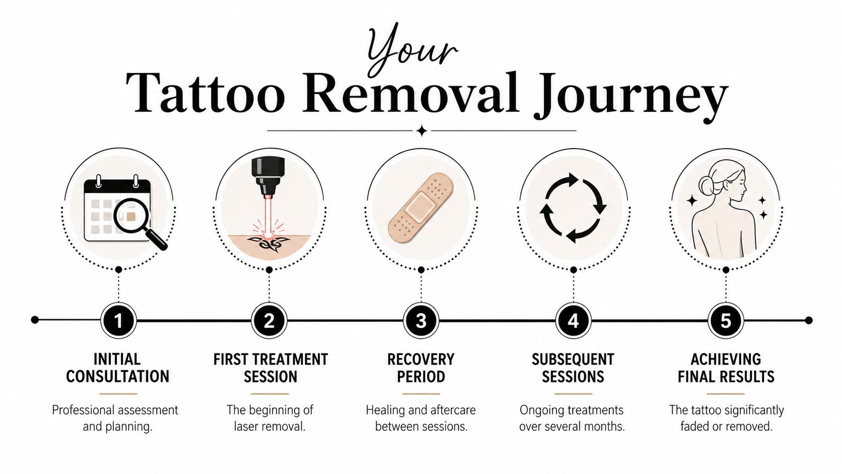 An infographic showing the five stages of a professional laser tattoo removal treatment journey.