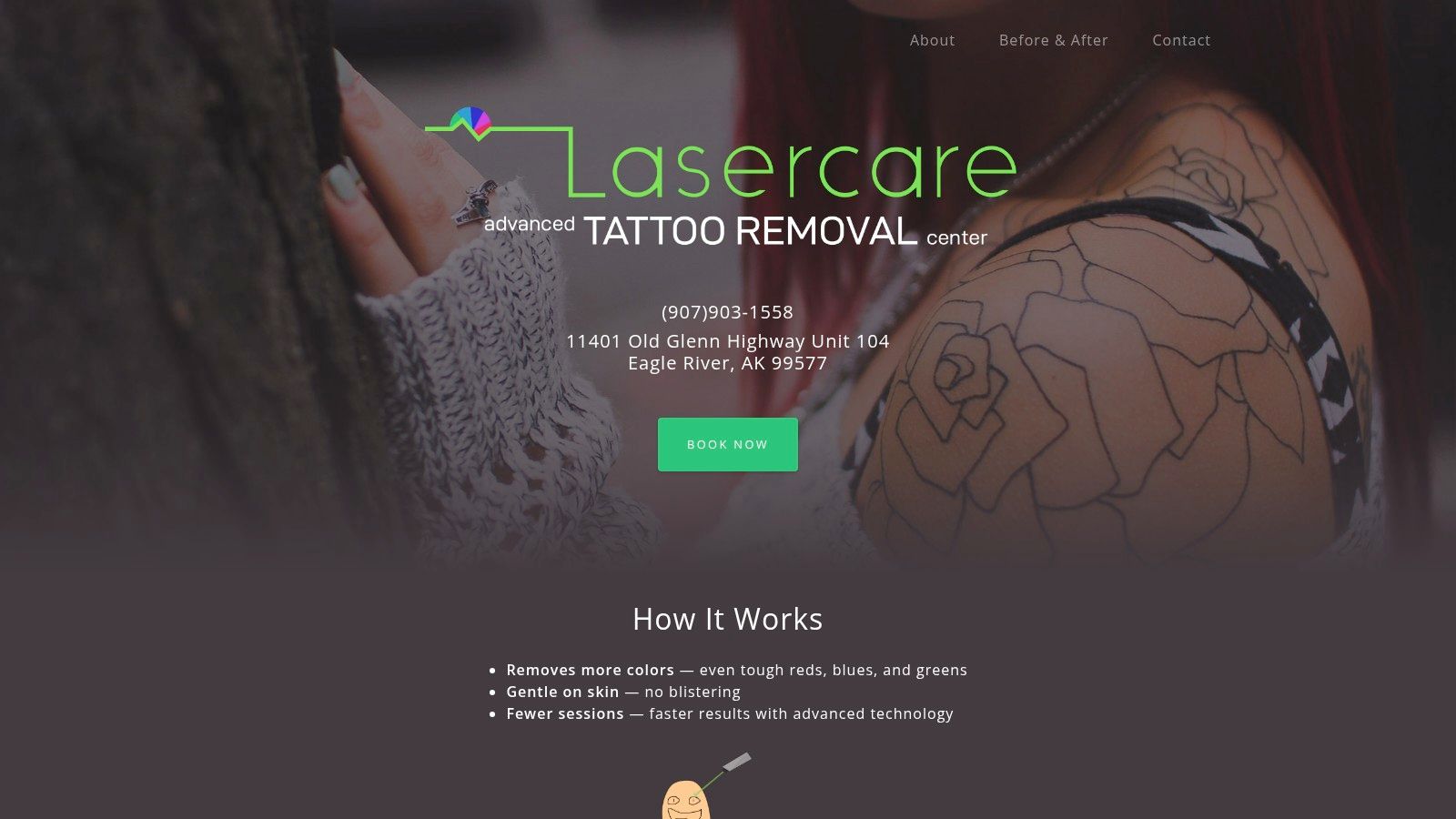 Lasercare Tattoo Removal