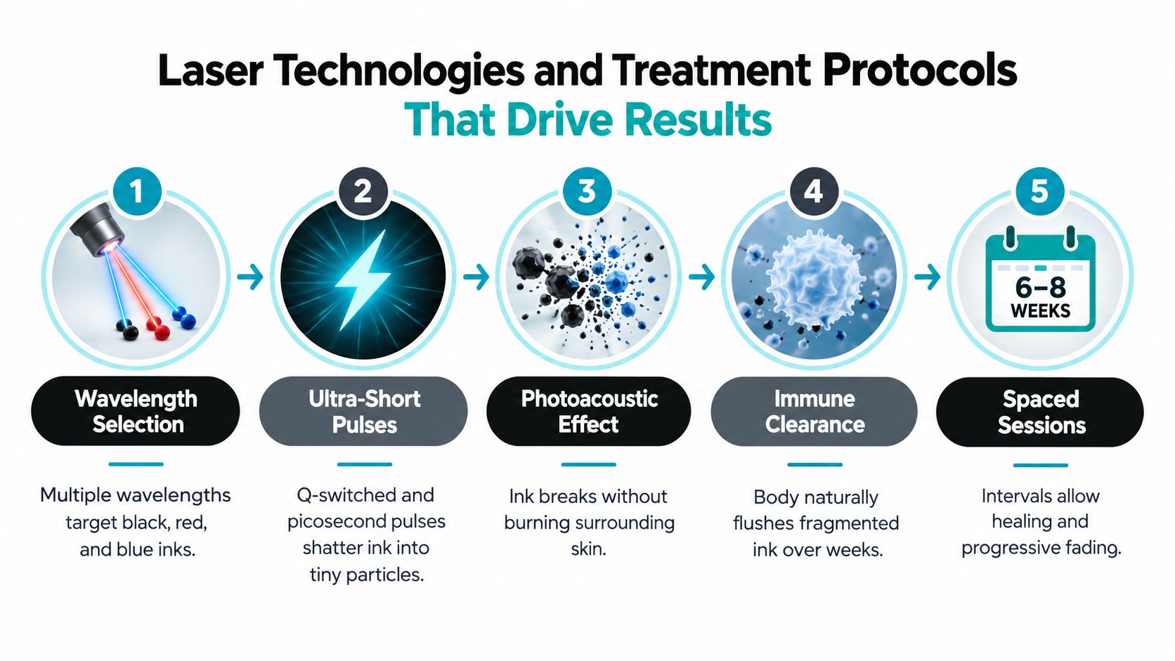 A five-step infographic explaining how laser technology works to remove tattoos through a progressive medical process.