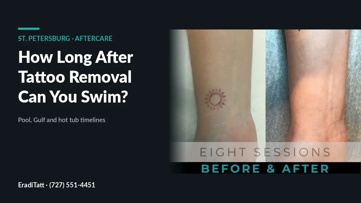 Before and after wrist tattoo removal, 8 sessions; swimming after laser tattoo removal guide for St. Petersburg