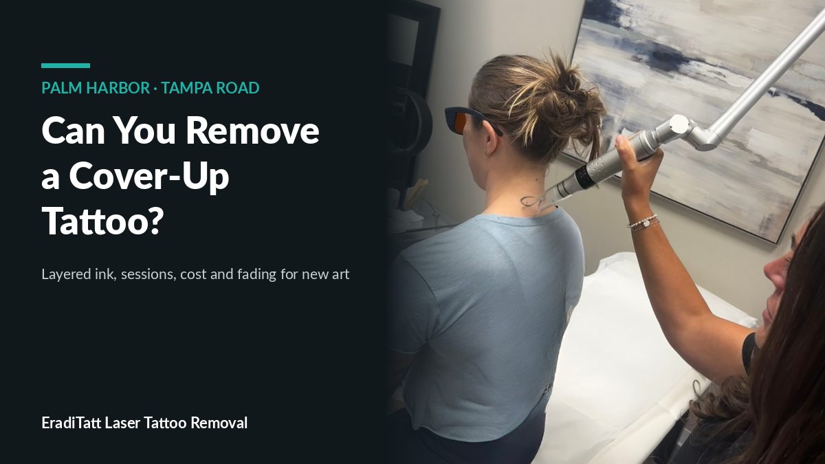 Laser treatment on a client's upper back tattoo at EradiTatt, illustrating cover-up tattoo removal near Palm Harbor, FL