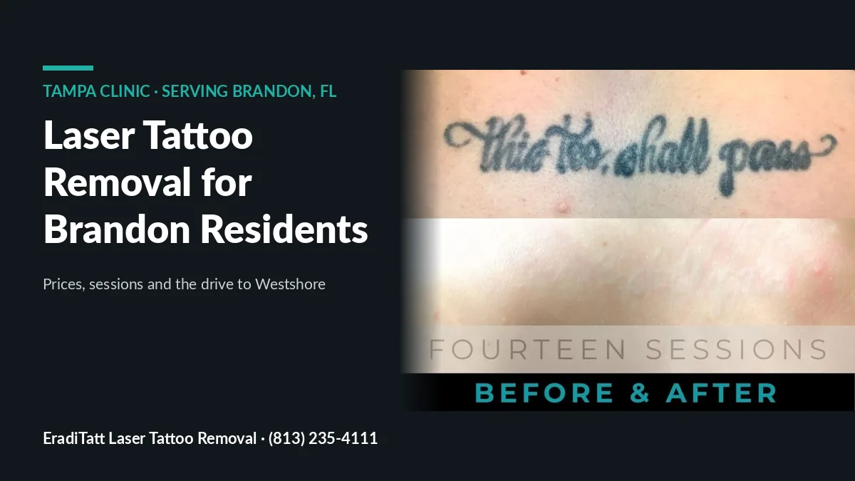 Before and after of a script chest tattoo cleared in 14 laser sessions, tattoo removal for Brandon, FL residents