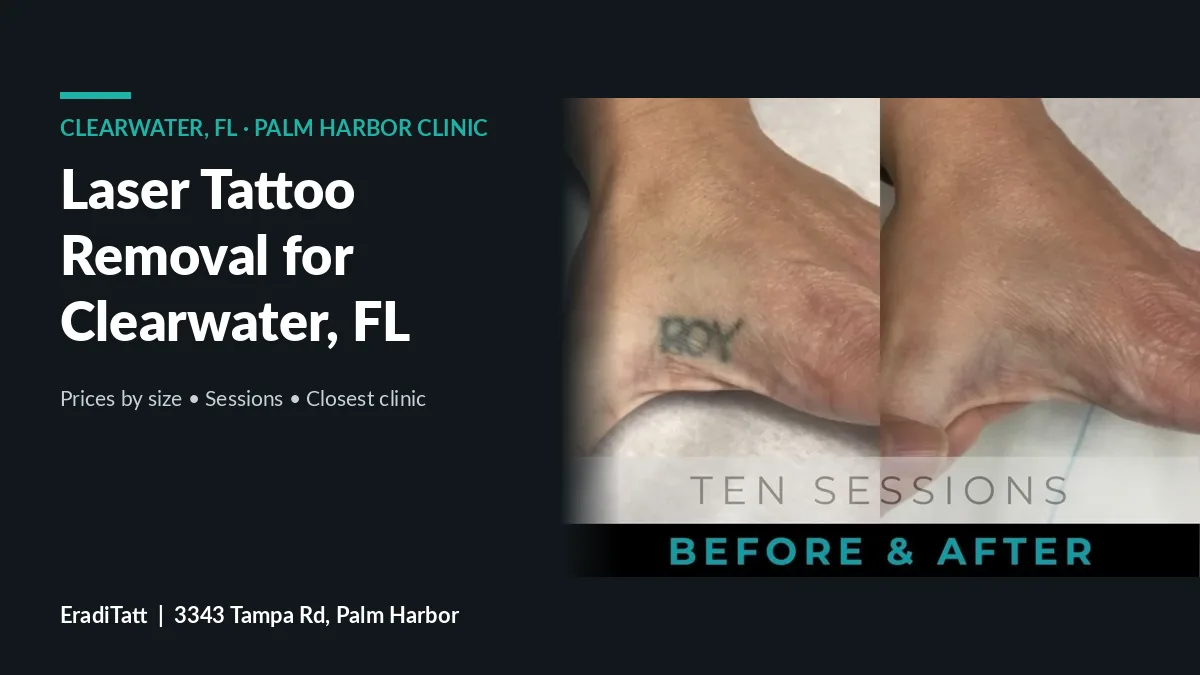 Before and after photo of a foot tattoo removed in 10 laser sessions, tattoo removal guide for Clearwater, FL