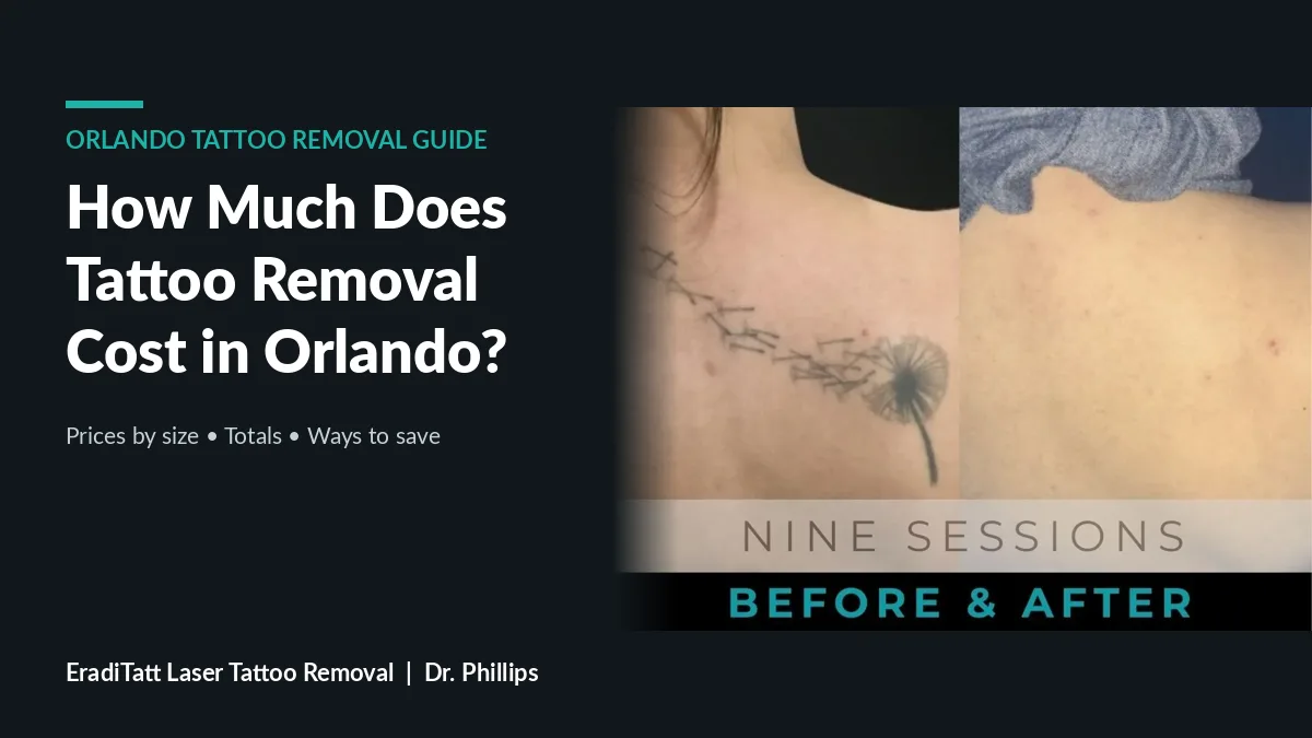 Before and after laser removal of a dandelion tattoo on the shoulder after 9 sessions, Orlando tattoo removal cost guide