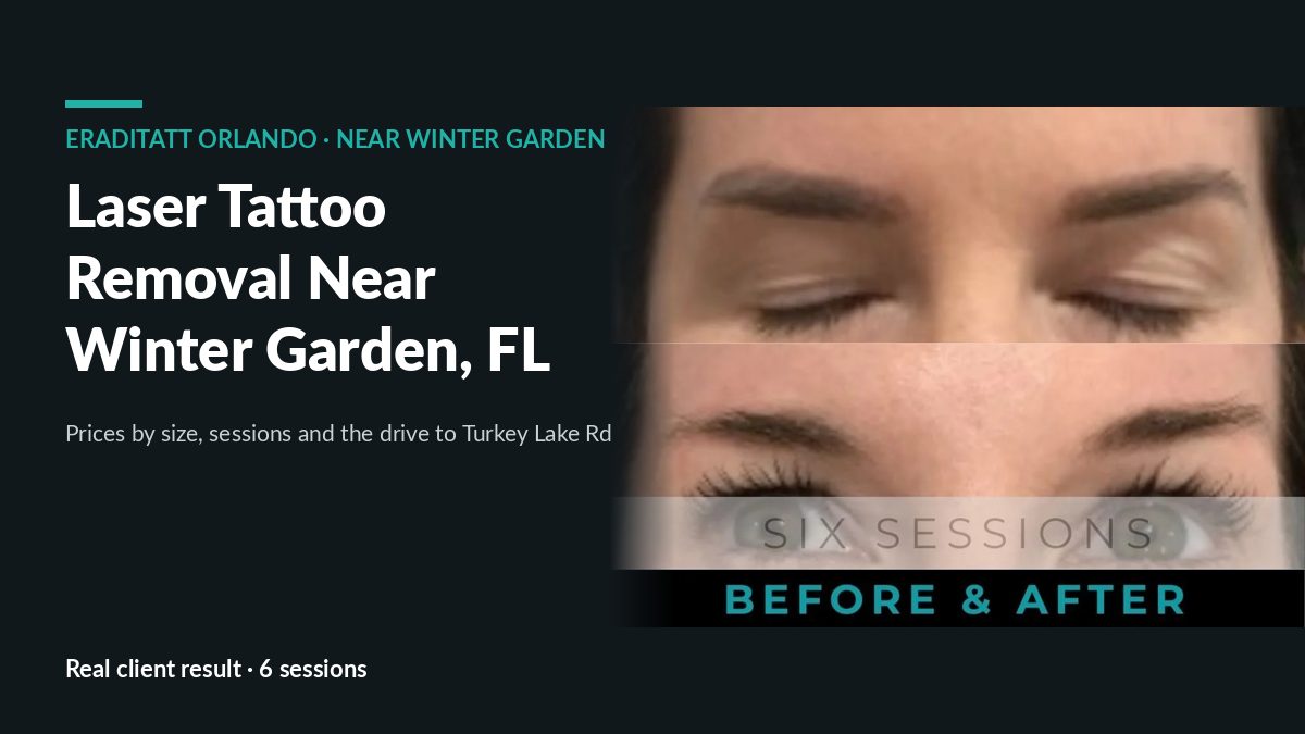 Before and after eyebrow tattoo removal after six laser sessions, for Winter Garden FL clients of EradiTatt Orlando